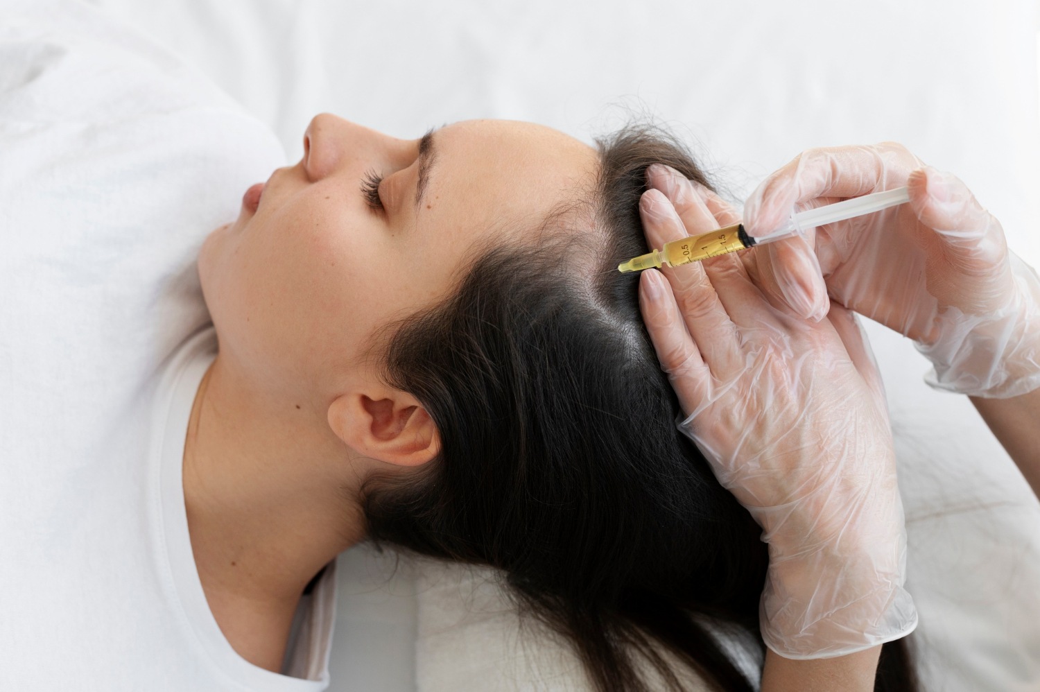 The picture of a dermatologist conducting mesothérapie Cheveux to her client